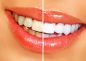 Preview: Emmi Dent Ultraschal Zahncremen - 75g Tube