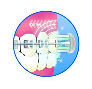 Emmi Dent Ultraschall Ersatzbürsten - 2er Pack